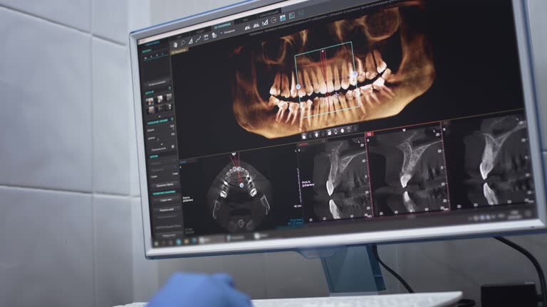 Dental X-Rays and Imaging in Farmersville, OH